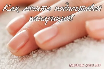 Подногтевой панарицій причини розвитку, класифікація, лікування та можливі ускладнення (ускладнення) Подногтевой панарицій причини розвитку, класифікація, лікування та можливі ускладнення