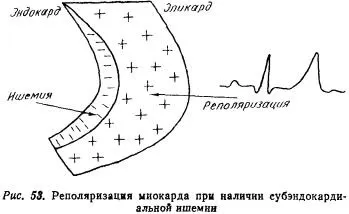 Посібник по ЕКГ (підручник) - розшифровка ЕКГ