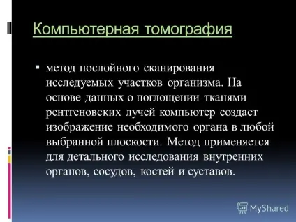 Презентація на тему рентгенологічне відділення кабінет комп'ютерної томографії (рентгенологічне відділення кабінет комп'ютерної томографії.) Презентація на тему рентгенологічне відділення кабінет комп'ютерної томографії