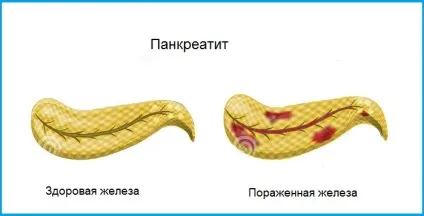 При яких хворобах турбує біль в правому боці живота
