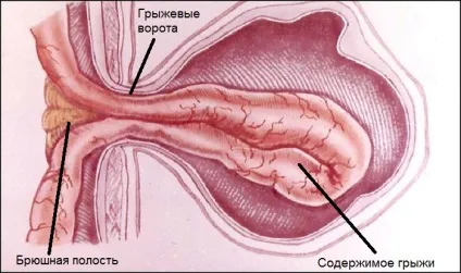 При яких хворобах турбує біль в правому боці живота