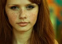 Родимки і ластовиння