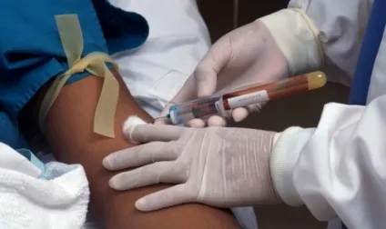 Росспоживнагляд розповів, як в українських лікарнях заражаються ВІЛ - статті і новини (Росспоживнагляд) Росспоживнагляд розповів, як в українських лікарнях заражаються ВІЛ - статті і новини
