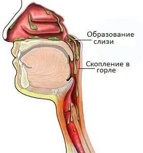 Слиз в носоглотці як позбутися і видалити скупчення (слиз) Слиз в носоглотці як позбутися і видалити скупчення