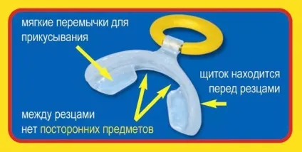 Соска для виправлення прикусу - запобігаємо дефект у дитини (прикусу) Соска для виправлення прикусу - запобігаємо дефект у дитини