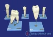 Стоматологічні навчальні моделі зуби, щелепи, захворювання (моделі) Стоматологічні навчальні моделі зуби, щелепи, захворювання