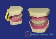 Стоматологічні навчальні моделі зуби, щелепи, захворювання (щелепи) Стоматологічні навчальні моделі зуби, щелепи, захворювання