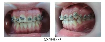 Стоматологічна поліклініка ніжгма ортопедичне відділення (відділення) Стоматологічна поліклініка ніжгма ортопедичне відділення