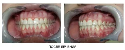 Стоматологічна поліклініка ніжгма ортопедичне відділення (ортопедичне) Стоматологічна поліклініка ніжгма ортопедичне відділення