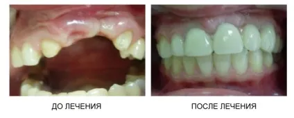 Стоматологічна поліклініка ніжгма ортопедичне відділення (стоматологічна) Стоматологічна поліклініка ніжгма ортопедичне відділення