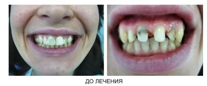 Стоматологічна поліклініка ніжгма ортопедичне відділення (відділення) Стоматологічна поліклініка ніжгма ортопедичне відділення