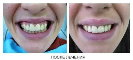 Стоматологічна поліклініка ніжгма ортопедичне відділення (ніжгма) Стоматологічна поліклініка ніжгма ортопедичне відділення