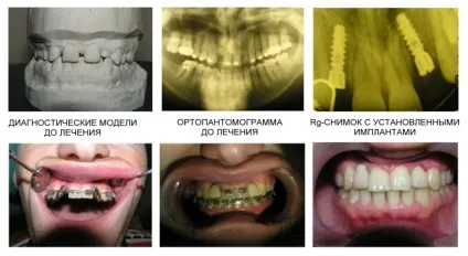 Стоматологічна поліклініка ніжгма ортопедичне відділення (відділення) Стоматологічна поліклініка ніжгма ортопедичне відділення