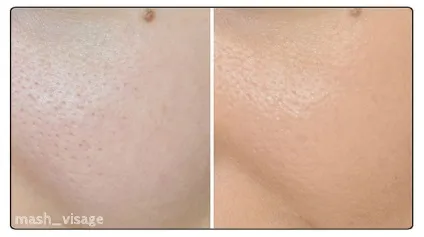 Тональний крем rimmel match perfection light perfecting radiance foundation - 103 true (rimmel) Тональний крем rimmel match perfection light perfecting radiance foundation - 103 true