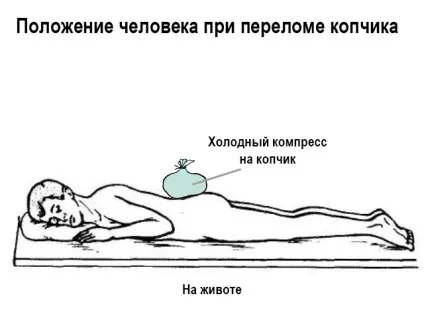 Травма куприка симптоми лікування народними засобами (лікування) Травма куприка симптоми лікування народними засобами