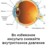 Вправи дихальної гімнастики після інсульту і травми (дихальна гімнастика при інсульті) Вправи дихальної гімнастики після інсульту і травми