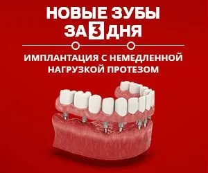 Догляд за металокерамічними зубами (зубами) Догляд за металокерамічними зубами