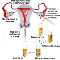 У яких випадках роблять еко, показання до еко (показання) У яких випадках роблять еко, показання до еко