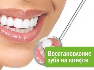 Відновлення зуба на штифті, скловолокном (Відновлення зуба штифті) Відновлення зуба на штифті, скловолокном