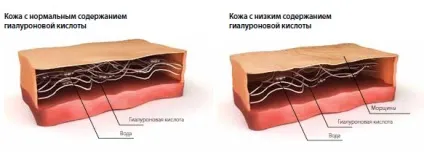 Шкода і користь гіалуронової кислоти ін'єкції для особи (шкода) Шкода і користь гіалуронової кислоти ін'єкції для особи
