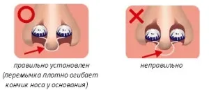 Японські фільтри для носа від алергії - види і способи використання (носа) Японські фільтри для носа від алергії - види і способи використання