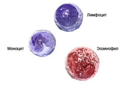 Хронічний мієлолейкоз особливості хвороби, лікування (хронічний) Хронічний мієлолейкоз особливості хвороби, лікування