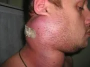 Захворювання, сопустствующіе вич, СНІДу (вимагають обов'язкового лікування) Захворювання, сопустствующіе вич, СНІДу