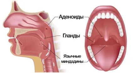 Здорові гланди як виглядає горло хворе і здорове
