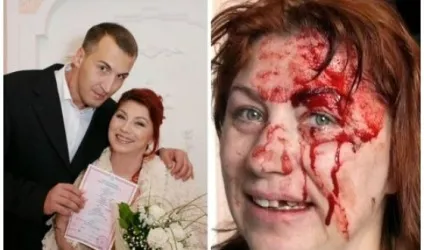 Роза Сябітова до і після пластичних операцій, фото і відео (троянда) Роза Сябітова до і після пластичних операцій, фото і відео