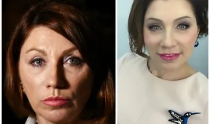 Роза Сябітова до і після пластичних операцій, фото і відео (Сябитова) Роза Сябітова до і після пластичних операцій, фото і відео