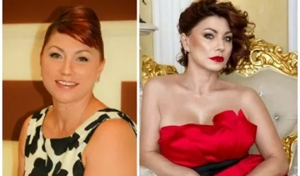 Роза Сябітова до і після пластичних операцій, фото і відео (Сябитова) Роза Сябітова до і після пластичних операцій, фото і відео