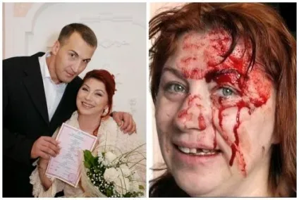 Роза Сябітова до і після пластичних операцій, фото і відео (Сябитова) Роза Сябітова до і після пластичних операцій, фото і відео