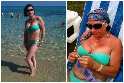 Роза Сябітова до і після пластичних операцій, фото і відео (троянда) Роза Сябітова до і після пластичних операцій, фото і відео