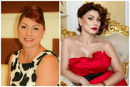 Роза Сябітова до і після пластичних операцій, фото і відео (після) Роза Сябітова до і після пластичних операцій, фото і відео