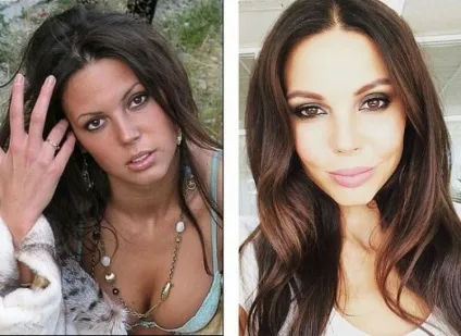 10 українських милашек, які вбили свою красу надмірної пластикою - стартова сторінка - все саме (свою) 10 українських милашек, які вбили свою красу надмірної пластикою - стартова сторінка - все саме
