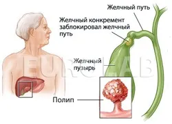 Альбано Каррізі