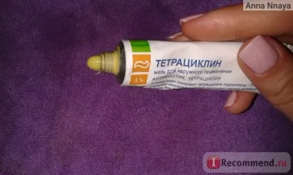 Антибіотик Нижфарм тетрациклін, мазь для зовнішнього застосування - «дієва і недорога штука від