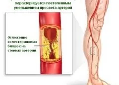 Боротьба з наркоманією, курінням і алкоголізмом (алкоголізм) Боротьба з наркоманією, курінням і алкоголізмом