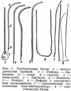 Бужування уретри у жінок і чоловіків (бужування) Бужування уретри у жінок і чоловіків