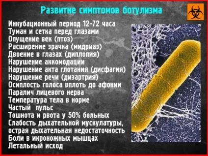 Ботулотоксин - що це, застосування, наслідки отруєння (застосування) Ботулотоксин - що це, застосування, наслідки отруєння