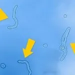 Деструкція склоподібного тіла ока ніж небезпечно, знайдено рішення, лікування народними засобами, як (як вилікувати деструкцію склоподібного тіла ока) Деструкція склоподібного тіла ока ніж небезпечно, знайдено рішення, лікування народними засобами, як