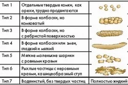 Діарея мандрівників лікування і профілактика (лікування) Діарея мандрівників лікування і профілактика