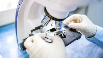 Дирофіляріоз у кішок причини, способи виявлення та лікування (дирофіляріоз) Дирофіляріоз у кішок причини, способи виявлення та лікування