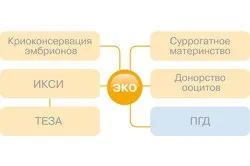 Еко при чоловічому безплідді методики зачаття (безплідді) Еко при чоловічому безплідді методики зачаття