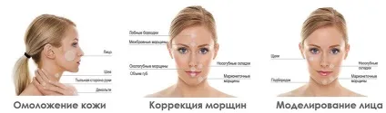 Filery, філлер, види філерів (заповнення носогубних складок) Filery, філлер, види філерів
