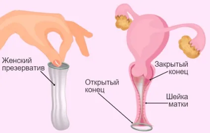Фемідоми - жіночий презерватив як користуватися, плюси і мінуси (фемідоми) Фемідоми - жіночий презерватив як користуватися, плюси і мінуси