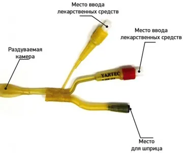 Гайморит симптоми і лікування у дітей в домашніх умовах (лікування) Гайморит симптоми і лікування у дітей в домашніх умовах
