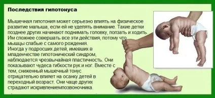 Гипотонус у грудничка