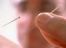 Голка для похуденія- особливості процедури, відгуки (голка) Голка для похуденія- особливості процедури, відгуки