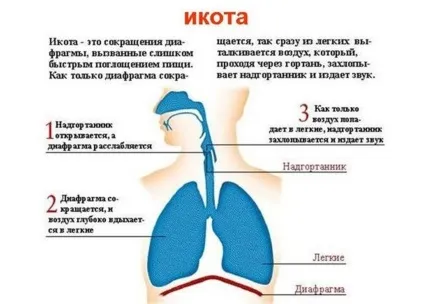 Гикавка у новонароджених причини появи і методи усунення (гикавка) Гикавка у новонароджених причини появи і методи усунення